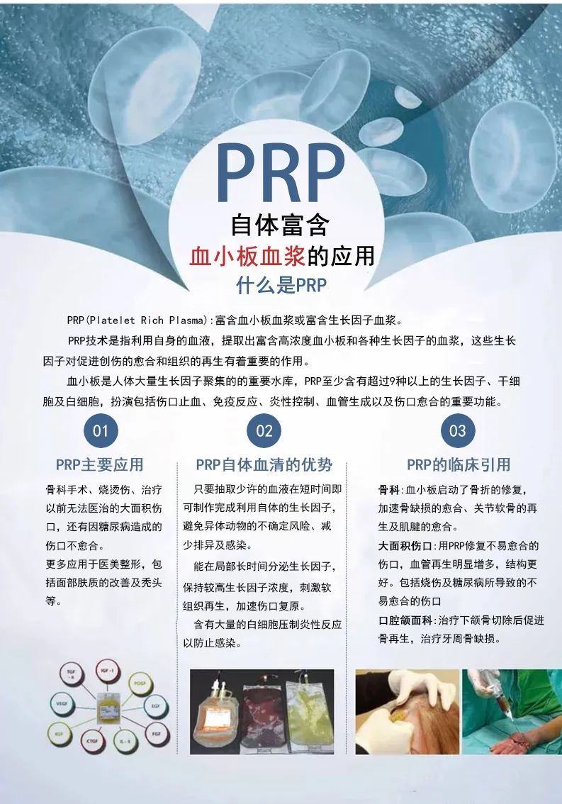 PRP6.jpg